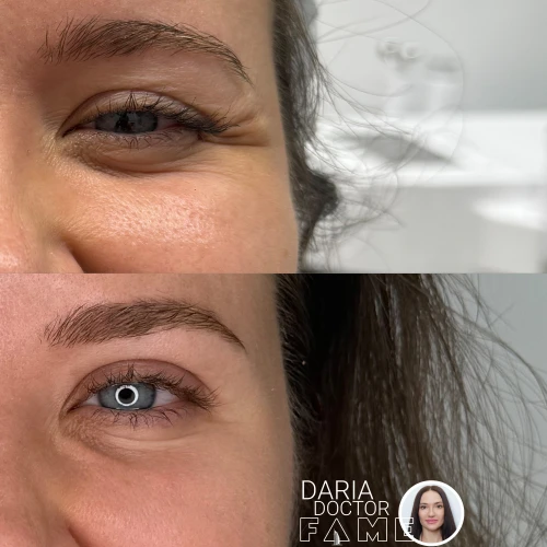 About The FAME