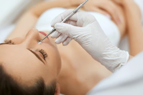 DEEP SKIN CLEANSING WITH ACID TREATMENT